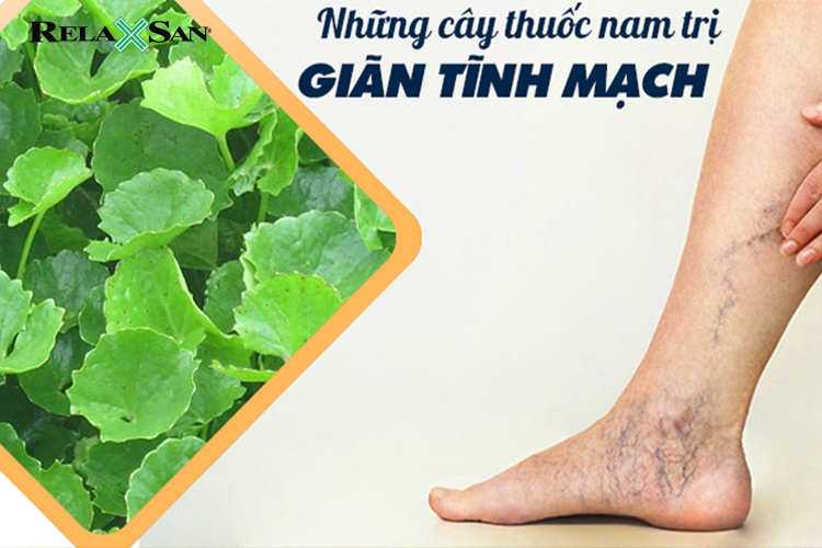 10+ cây thuốc nam giúp chữa suy giãn tĩnh mạch