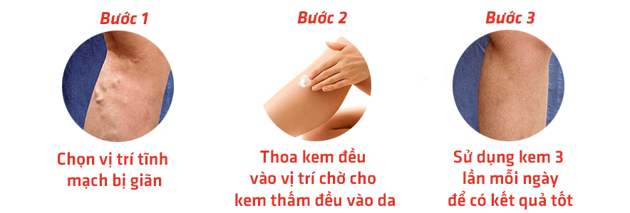 Các bước sử dụng kem chữa giãn tĩnh mạch Varikosette