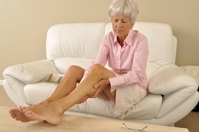 5 phương pháp giảm đau đơn giản cho người suy giãn tĩnh mạch chân