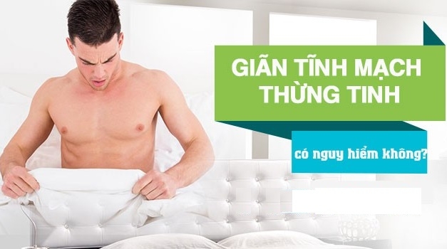 Giãn tĩnh mạch thừng tinh hay giãn tĩnh mạch tinh hoàn là gì?