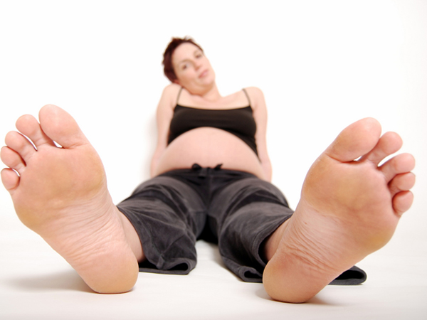 Giãn tĩnh mạch thai kỳ không chỉ ở chân